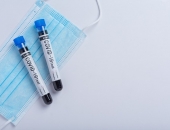 Klātienē strādājošajiem vismaz divas reizes nedēļā būs jātestējas