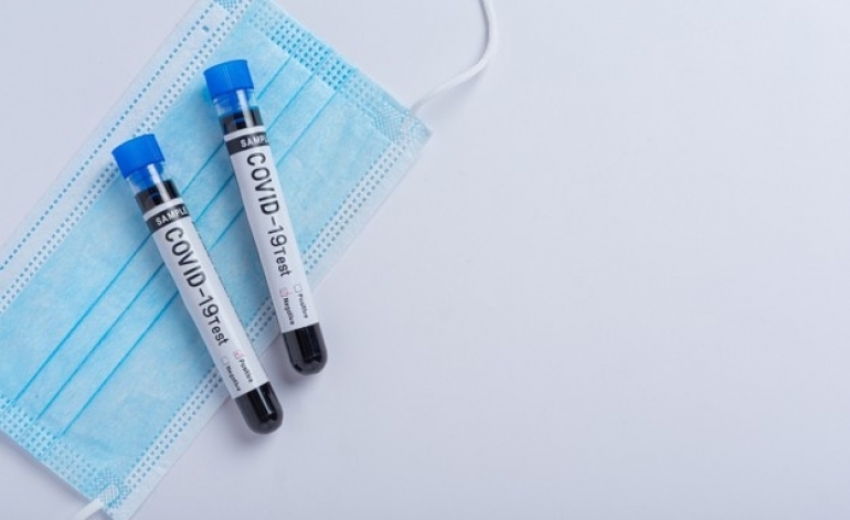 Klātienē strādājošajiem vismaz divas reizes nedēļā būs jātestējas